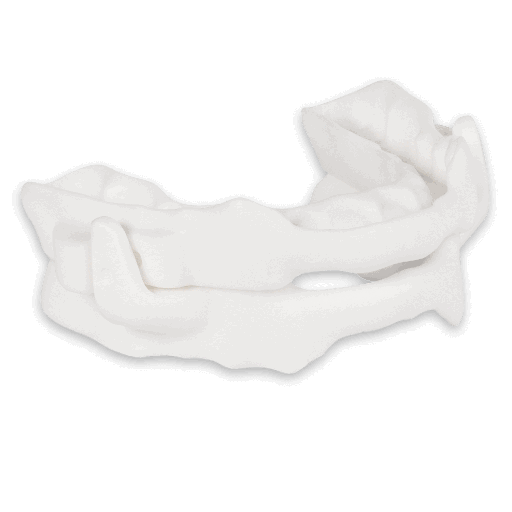 Custom oral appliance for sleep apnea
